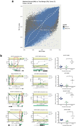 Figure 1. Matched normal tissue is epigenetically benign. (a), generalized additive model indicates that tumor group had increased methylation at probes hypomethylated in MN, whereas TB had a near-linear relationship with MN. (b), Schematic methylation maps for GSTP1, APC, SFRP2 and RASSF1 genes and DMRs (tumor versus MN). Gene structure and CpG islands (green) are indicated below the graphs. DMRs are indicated in the red boxes and show probes contained within the rank cut-off identified through the RnBeads differential methylation analysis. For comparative purposes, the β-values (extracted from a HM450K platform) for a cohort of TB prostate tissues from men with no evidence of PCa are also indicated. EPIC/HM450K probe β-values are indicated by filled circles. Statistical analysis was carried out using a Kruskal–Wallis and Dunn’s multiple comparison tests. P-values are as follow: *P≤ 0.05, ** P≤ 0.01, *** P≤ 0.001. Abbreviations: MN: matched normal, TB: true benign, DMRs: differentially methylated regions.