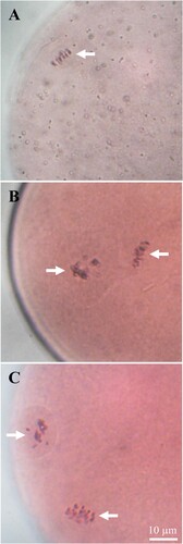 Figure 4. In vitro meiotic competence of oocytes collected from goats fed different levels of dietary energy. From top to down, it represents low (A), medium (B) and high (C) level of energy in the experimental diet. Large antral follicles (4–6 mm in diameter) were dissected from ovaries, and follicles were opened using a pair of forceps, and cumulus-oocyte complexes (COCs) were collected. COCs were cultured in TCM-199 supplemented with FBS, FSH, sodium pyruvate and gentamicin sulphate at 38.5°C under 5% CO2 in humidified air for 24 hrs. After denudation, oocytes were fixed in aceto-ethanol (acetic acid: ethanol = 1:3) for 48 h and stained with 1% (w/v) aceto-orecin. Chromosomes were indicated by arrows. Scale bars represent 10 µm.