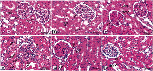 Figure 6. Photomicrographs of histological kidney sections presented the effect of drug ‘4i’ in all tested groups: (A) Kidney section from G1 showed normal glomerulus (G), bowman’s capsule (B), proximal convoluted tubules (PCT), and distal convoluted tubules (DCT). Kidney sections from G4 (B) and G5 (C) displayed a picture resembling G1. (D) Histological kidney cells from G9 exhibited a nucleus with pyknosis (P), karyorrhexis (KR), and karyolysis (KY). Notice cytoplasmic vacuolations (V), congestion (CN), and inflammatory cells infiltrations (IN). (E) Sections from G12 presented specified cells of pyknotic (P) and karyolitic (KY) nucleus besides a few inflammatory cells (IN). (F) Sections from G13 existed nearly like the normal glomerulus (G) and distal convoluted tubules (DCT). karyorrhexis (KR) was noticed lining a few cells in proximal convoluted tubules. (H&E staining, 400x Magnification, Scale bar = 50 μm).