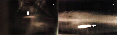 Figure 2. (A) Ventro-dorsal image, the radiopaque bolus (arrow) is observed. (B) Dorso-ventral image, the radiopaque bolus (arrow) is observed.