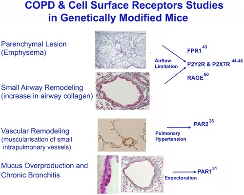 Figure 3 Studies on cell surface receptors and COPD were carried out in genetically modified mice. Genetic ablation of the formyl-peptide receptor-1 (fpr-1) gene in mice, or treatment with specific antagonists of FPRs prevents recruitment of inflammatory cells in the lung leading to a complete protection from smoking-induced lung emphysema and airway remodelling (84). CS-induced neutrophilic inflammation and emphysema can be also statistically lowered upon inhibition of RAGE, or purinergic receptor subtypes (such as P2Y2R or P2X7R) as demonstrated in RAGE (60), or P2Y2R and P2X7 knockout mice (44, 45). After chronic CS-exposure, par2 gene overexpression in FVB mice leads to emphysematous changes associated with PH and RVH (26). The absence of proteinase-activated receptor-1 signaling in C57 Bl/6 mice confers protection form FMLP-induced goblet cell metaplasia (51). This image is the property of the authors.