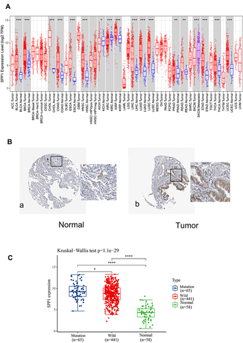Figure 4 (A) Validation of the SPP1 expression in multiple tumors. (B) Validation of the SPP1 expression by the Human Protein Atlas database. a. SPP1 of immunohistochemistry in normal lung tissue; b. SPP1 of immunohistochemistry of LUAD tissue. (C) SPP1 expression in EGFR-mutant/wild LUAD and normal groups from TCGA. P value significant codes: *P < 0.05, **P < 0.01, ***P < 0.001, ****P < 0.0001.