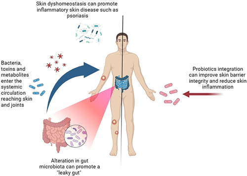 Figure 1 Relationship between skin and gut microbiome. Diet and gastrointestinal diseases have an impact on the skin functions. Intestinal dysbiosis increases intestinal permeability and promotes the migration of bacteria, toxins and metabolites into the bloodstream, reaching skin and joints. Skin dyshomeostasis can induce inflammatory skin disease including psoriasis. Probiotics integration may improve skin condition by reducing inflammation, improving the barrier function, modulating immune activation, and hindering the colonization of harmful bacteria.