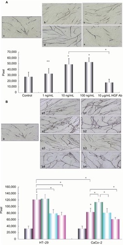 Figure 5 Effect of HGF and co-cultured colon cancer cells on angiogenesis.