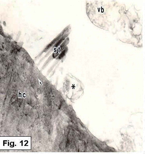Figure 12. Hypophthalmichthys molitrix, 7 days after hatching. TEM micrograph of a sensory hair cell (hc), showing the stereocilia (st) which is planted in a cuticular plate (arrow). Secretory materials, as vesicular bodies (vb) containing numerous spherules and other vesicles (asteriske), are also seen. 15,000×.