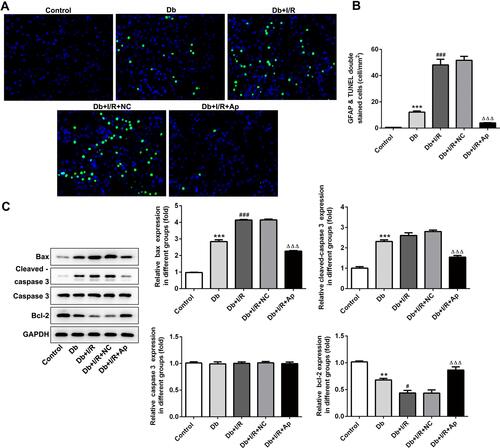 Figure 3 Impacts of Apelin on the apoptosis. (A) TUNEL assay was utilized to measure cell apoptosis in five groups. (B) Statistical analysis of apoptosis. (C) Western blot assessed the protein levels of apoptosis-related proteins. **p<0.01, ***p<0.001 vs control; #p<0.05, ###p<0.001 vs Db; ΔΔΔp<0.001 vs Db+I/R+NC.