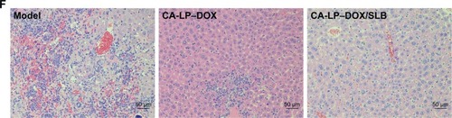 Figure 7 In vivo antitumor effects of different DOX formulations in subcutaneous H22-bearing mice and orthotopic HepG2-bearing nude mice models.Notes: (A) Relative BW of subcutaneous mice H22 xenografts mice. Data are presented as mean ± SD (n=5). (B) Tumor volume of tumor in subcutaneous mice H22 xenografts models. Data are presented as mean ± SD (n=5). *P<0.05. (C) The representative photograph in subcutaneous mice H22 xenografts models. (D) Photograph of excised liver tumors at the end of the experiment of orthotopic HepG2-bearing nude mice. (E) Excised liver tumor weights of orthotopic HepG2-bearing nude mice. Data are presented as mean ± SD (n=5). *P<0.05. (F) Histological section of liver tissue of orthotopic HepG2-bearing nude mice (magnification ×200).Abbreviations: BW, body weight; CA-LP, DSPE-PEG-cholic acid-modified liposomes; DOX, doxorubicin; SLB, silybin.