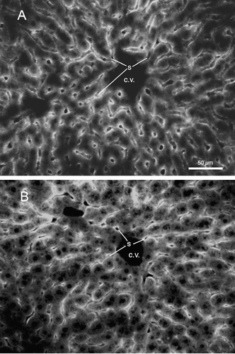 FIG. 6 Fluorescence image, using rhodamine optics, of 12 μ m crytostat sections of liver showing patterns of liposome labeling in an mouse euthanized 15 min following intravenous injection of the “7%/2%” formulation of peptide-containing liposomes (see Table 1). Note the intense liposome labeling along the sinusoidal borders, and the lighter labeling within the cytoplasm of hepatocytes. S: sinusoidal capillaries; C. V.: central vein; calibration bar = 50 μ m. (A) Single injection. (B) Third injection of liposomes at 14-day intervals.