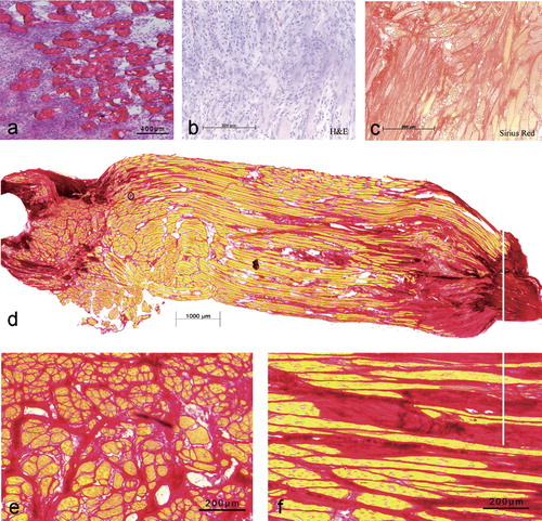 Figure 6. Histological staining of soleus muscles 4 days and 1, 4, and 8 weeks after crush injury. a. Cryo-section with HE staining of cross-sectioned myofibers surrounded by inflammatory cells on day 4 after injury. b. Paraffin section with HE staining of regenerating myofibers showing loose deposition of connective tissue with a high degree of cellularity and regenerating muscle fibers one week after trauma. c. Paraffin section with HE staining showing dense connective tissue with local scar formation and interstitial fibrosis 4 weeks after injury. d. Cryo-section with Sirius red staining: an overview of the injured soleus muscle 8 weeks after trauma showing typical interstitially pronounced fibrosis in the distal and proximal crush zone. e. Detail of panel d showing cross-sectioned myofibers surrounded by collagenous fibrotic tissue. f. Detail of panel d showing (longitudinally) sections of myofibers and interstitial fibrosis.