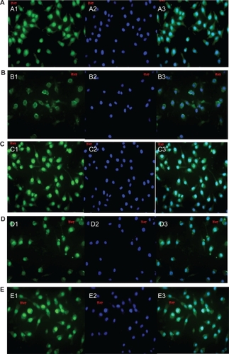 Figure 5 Confocal images of protein kinase Cα (PKCα) expression in retinal pigment epithelium (RPE) cells by different treatments. PKCα staining was much lighter in the small interfering RNA (siRNA)-PKCα treatment than in the control, with no significant difference in the released siRNA-PKCα treatment groups. (A) blank control. (B) RPE cells treated with 100 nM siRNA-PKCα. (C–E) RPE cells treated with siRNA-PKCα released from foldable capsular vitreous bodies containing 400, 500, and 600 nM siRNA-PKCα, respectively. (1) PKCα staining in the cytoplasm and nuclei of RPE cells. (2) Staining of the nuclei with Hoechst 33342. (3) An overlay of images 1 and 2. Scale bars, 20 μm. Magnification × 1000.