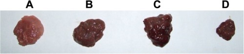 Figure 4 (A–D) Effect of Fe3O4-dextran-anti-β-human chorionic gonadotropin (HCG) carrying heparanase (Hpa) antisense oligodeoxynucleotide (ASODN) on hypodermal transplant tumors in nude mice. (A) Saline solution-treated hypodermal transplant tumor. (B) Fe3O4-dextran-anti-βHCG nanoparticle-treated hypodermal transplant tumor. (C) Fe3O4-dextran-anti-βHCG-Hpa nonspecific oligodeoxynucleotide-treated hypodermal transplant tumor. (D) Fe3O4-dextran-anti-βHCG-Hpa ASODN-treated hypodermal transplant tumor.