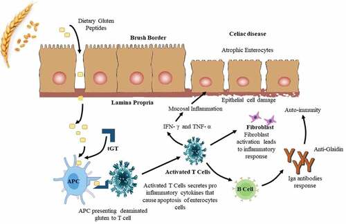 Figure 3. Celiac disease mechanisms.