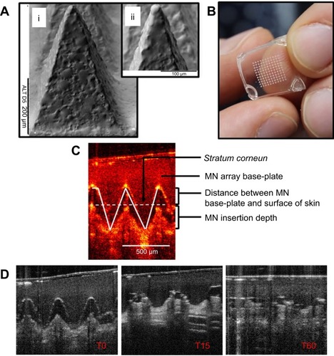 Figure 1 (A) Scanning electron microscope images of DMN, 500 µm in height and with 300 µm width at base. (B) A DMN, prior to application to the skin. (C, D) Representative optical coherence tomography (OCT) images showing DMN insertion in skin (C) and DMN dissolution in skin at time 0, 15 mins and 60 mins (D). Reproduced from Rodgers AM, McCrudden MT, Vincente-Perez EM, et al. Design and characterisation of a dissolving microneedle patch for intradermal vaccination with heat-inactivated bacteria: a proof of concept study. Int J Pharm. 2018;549(1–2):87–95. Creative commons license and disclaimer available from: http://creativecommons.org/licenses/by/4.0/legalcode.Citation10