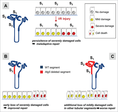 Figure 1. Schematic illustration of targeted deletion of Atg5 in the 3 segments of the proximal tubule (S1-S3) and its effect on the course of ischemic kidney injury. Renal ischemia/reperfusion (I/R) results in tubular epithelial cell injury where the S3 segment of the proximal tubule is most susceptible to damage. (A) Epithelial cell injury in autophagy-enabled wild-type tubular segments results in survival and persistence of severely damaged cells leading to aberrant renal repair. (B) The targeted deletion of Atg5 in S3 tubular segment results in rapid and selective loss of severely damaged autophagy-suppressed epithelial cells. This improves the regenerative milieu leading to improved renal repair. (C) The extended deletion of Atg5 in S1-S2-S3 segments or the entire tubule results in a worse outcome as less damaged epithelial cells are lost that would normally contribute to tubular repair.