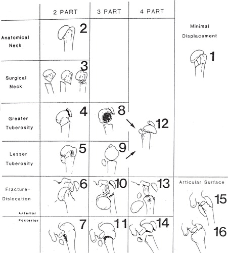 Figure 1. The 16 categories of the Neer classification. A fracture is considered displaced if one or more of the four anatomical segments (greater tuberosity, lesser tuberosity, the humeral head, or the humeral shaft) are displaced more than 1 centimeter or angulated more than 45°. Modified from Neer (Citation1970) 15 with permission from JBJS Am, Rockwater Inc.