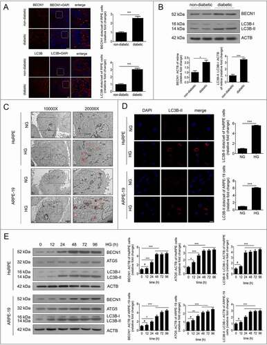 Figure 1. Autophagic vacuoles and markers accumulate in RPE cells during DR progression. (a) The RPE cells of non-diabetic and STZ-induced diabetic rats were flat-mounted (all the non-diabetic and STZ-induced diabetic rats were fed with a regular diet) and then stained for BECN1 and LC3B. The pictures were taken on the upper retina 100 μm away from the optic nerve. Scale bars: 10 μm, n = 10. (b) Western blot was performed to quantify the expression levels of BECN1 and LC3B in the retinas of non-diabetic and diabetic rats (all the non-diabetic and STZ-induced diabetic rats were fed with a regular diet); representative images from three independent experiments with biological and technical replicates are shown, n = 10. (c) After exposure to NG (5.5 mM) or HG (25 mM) for 24 h, HsRPE and ARPE-19 cells were processed for TEM imaging. Magnifications of the boxed areas are presented on the right. Arrowhead, autophagic vacuole; black delineation, AP; red delineation, electron-dense AL. Note the accumulation of AL in HG conditions. Scale bars: 2 μm (left), 1 μm (right), n = 6. (d) Immunofluorescence staining of LC3B-II showing quantitative changes in HsRPE and ARPE-19 cells after exposure to NG or HG for 24 h; representative images from three independent experiments with biological and technical replicates are shown. Scale bars: 25 μm, n = 6. (e) After exposure to HG for 0, 12, 24, 48, 72, and 96 h, HsRPE and ARPE-19 cells were subjected to western blot analysis using the indicated antibodies (BECN1, ATG5, LC3B, and ACTB). ACTB was used as a protein loading control; representative images from three independent experiments with biological and technical replicates are shown, n = 6. #P > 0.05; *P < 0.05; **P < 0.01; ***P < 0.001.