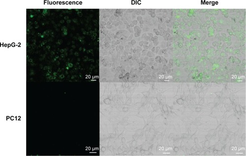 Figure 3 CLSM images of human STAT5b mRNA-expressing HepG-2 cells (upper panels) and nonhuman STAT5B-expressing PC12 cells (lower panels), treated with STAT5b beacon.Abbreviations: CLSM, confocal laser scanning microscopy; DIC, differential interference contrast microscopy; STAT5b, signal transducer and activator of transcription 5b.