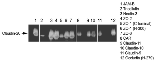 Figure 3. Immunoprecipitation of some tight junction proteins by Claudin-20.