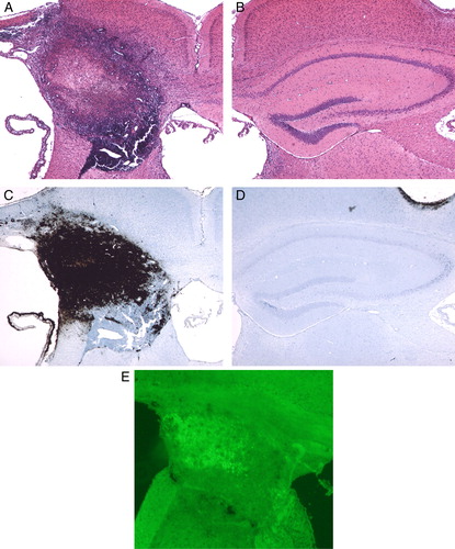 Figure 1. Photomicrographs of HE (A, B), Peal's (C, D), and TUNEL staining (E) after continuous injection of Fe-NTA for 2 weeks. Note that robust inflammation was induced in and around the hippocampus. An apoptotic change was induced in the hippocampus, but not in the vicinity. (Original magnification ×40.)