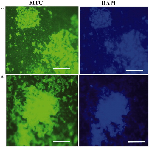 Figure 4. In vitro expression analysis of collagen type II and aggrecan markers on PES Scaffold. Immunofluorescence for collagen type II (A) and aggrecan markers (B) in chondrogenic differentiated IPSC after 21 d of in vitro differentiation. Staining of nucleus was performed by DAPI (blue), scale bars are 100 μm.