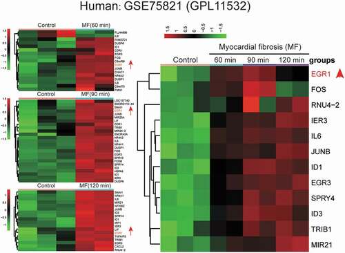 Figure 1. Microarray analysis of human MF cells.