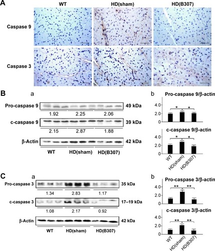Figure 8 Expressions of caspase 9 and caspase 3, two markers of apoptosis, in the heart tissue of R6/2 HD mice under oral B307 treatment and of their WT.