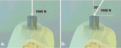 Figure 4. Von Mises values in conical implants. Vertical loading (a); oblique loading (b).