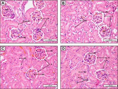 Figure 8 Photomicrographs of kidneys from: (A) the CN group; (B) the Z1 group (8 mg/kg); (C) the ZII group (16 mg/kg); and (D) the ZIII group (20 mg/kg).