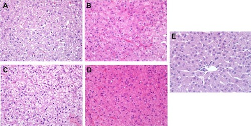 Figure 5 Effects of IONPs in the liver of the rhesus monkeys by H&E staining.Notes: Original magnification: ×400. (A and B) are the liver samples of Monkey 1 at 24 hours and 3 months posttreatment, respectively. (C and D) are the liver samples of Monkey 2 at 24 hours and 3 months posttreatment, respectively. Obvious swelling of hepatocytes and minimal necrosis were seen at 24-hour posttreatment stage, as well as recovery to normal with little swelling of hepatocytes in Monkey 1 at the 3-month posttreatment stage, compared with the negative control. No significant differences between (A and C) and between (B and D) were observed. (E) is the negative control.Abbreviations: IONPs, magnetic iron oxide nanoparticles; H&E, hematoxylin–eosin.