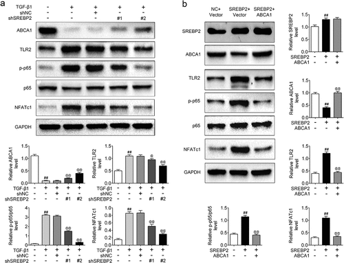 Figure 6. SREBP2 activated the TLR2/NF-κB/NFATc1 pathway by inhibiting the expression of ABCA1. shSREBP2, SREBP2 vector or ABCA1 vector were transfected into ASMCs, or 5 ng/mL TGF-β1 was treated with ASMCs. (a) The level of ABCA1, TLR2, p-p65, p65 and NFATc1, and (b) SREBP2, ABCA1, TLR2, p-p65, p65 and NFATc1 were detected by Western blotting. ## p < 0.01; # compare with the control group. @ p < 0.05, @@ p < 0.01; @ compare with the TGF-β1 + shNC or SREBP2 group.