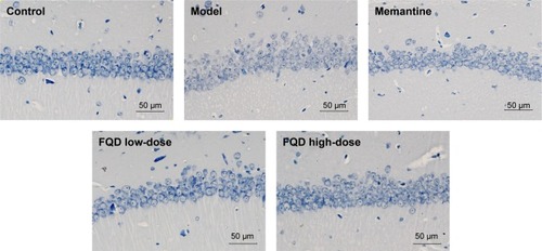 Figure 9 Effect of Fuzheng Quxie Decoction (FQD) on neuronal morphology in hippocampus CA1 region of SAMP8 mice.
