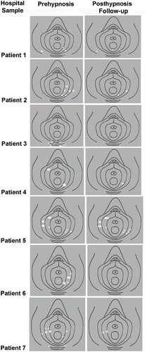 Figure 2. Physicians diagrams for the hospital sample shown reverse contrast for printability.