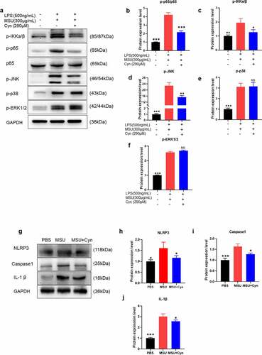 Figure 6. Cynarin inhibits the activation of NF-κB, JNK pathway and NLRP3 inflammasome induced by MSU. (a-j) Western blotting detected the protein levels of p-p38, p-ERK1/2, p-JNK, p-p65, p65, p-IKKa/β, Caspase1, NLRP3 and IL-1β, and analyzed these protein. Data were shown as mean ± standard deviation (SD) of three independent experiments. NS p>0.05, *p<0.05, **p<0.01, ***p<0.001 VS. the group handled by LPS and MSU together.