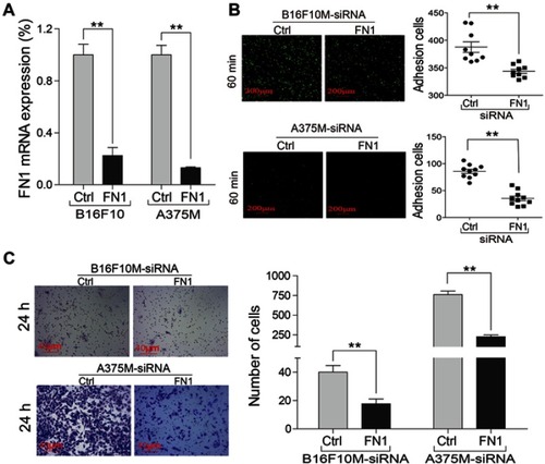 Figure 3 Downregulation of FN1 in metastatic melanoma cells significantly inhibited cell adhesion and invasion. (A) The RT-qPCR assay was used to validate the interference of FN1 in metastatic melanoma cells. (B) The cells' adhesive ability was analyzed by adhesion assay. (C) Cell invasion was measured by transwell invasion assay. FN1-decreased cells showed obviously lower penetration and adhesion ability compared to NC group. Representative pictures of these data were shown. Data are presented as mean ± SD. **P<0.01.Abbreviations: FN1, fibronectin 1; NC, negative control.