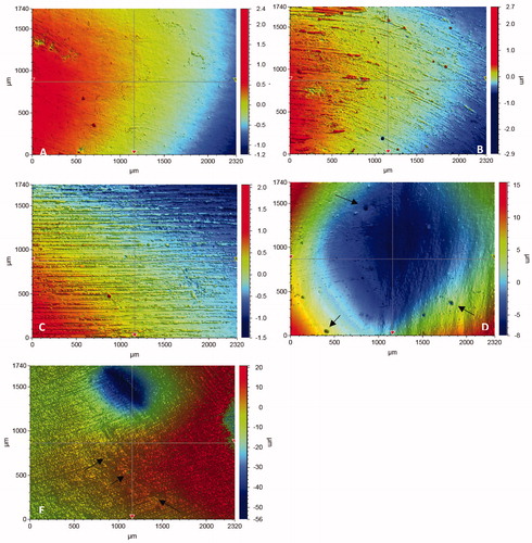 Figure 2. Typical 3 D surface profile of specimens in relation to different polishing protocols. A: 4000; B: 2000 grit; C: 1200 grit; D: Sof-Lex spirals; E: Abrasive points. Arrows indicate small pit defects.