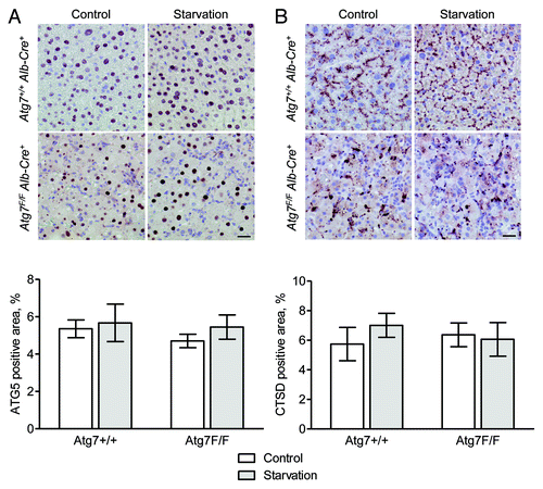 Figure 13. ATG5 and CTSD are not suitable targets for the immunohistochemical detection of autophagy in liver. Liver samples were isolated from fed Atg7+/+ Alb-Cre+ and Atg7F/F Alb-Cre+ mice (control) or from mice that underwent starvation for 48 h. After fixation in neutral buffered formalin for 24 h, tissues were paraffin-embedded and stained for ATG5 (A) or CTSD (B) using rabbit polyclonal anti-ATG5 (Abcam, 1:100) and rabbit monoclonal anti-CTSD (clone EPR3057Y, Abcam, 1:1000), respectively, in combination with Vectastain ABC. Heat-mediated antigen retrieval was performed in citrate buffer (pH 6.0). Scale bar, 20 μm. The ATG5- and CTSD-positive area was quantified. Neither the effect of starvation nor the results between Atg7+/+ Alb-Cre+ and Atg7F/F Alb-Cre+ mice were statistically significant.