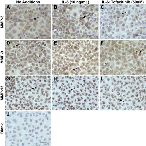 Figure 3 Immunohistochemistry of MMP3, MMP9 and MMP13 Antibody-Positive C28/I2 Chondrocytes in Response to IL-6 and the Effect of Tofacitinib (50nM) on MMP Antibody-Positive Chondrocytes. The scale is 50μm (A–J). Confluent C28/I2 chondrocytes were pre-treated with Tofacitinib (50nM) for 30 min followed by incubation with rhIL-6 (10ng/mL) or rhIL-6 plus Tofacitinib (50nM) for 1 hr. The “no-additions” group served as the control for rhIL-6-treated chondrocytes. The arrows in each panel indicate an MMP3, MMP9 or MMP13-positive C28/I2 chondrocyte. Panel J is a “blank” which shows the appearance of individual chondrocytes stained with hematoxylin. MMP3 (A–C); MMP9 (D–F); MMP13 (G–I); Appearance of confluent C28/I2 chondrocytes stained with DAB and hematoxylin (J).