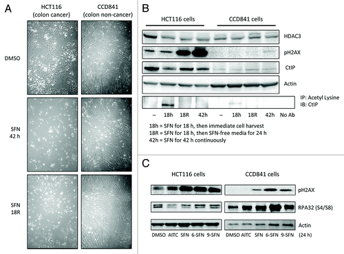 Figure 7. Differential responses of non-cancer cells and cancer cells to ITC-induced DNA damage. (A) Phase contrast images of HCT116 cells and CCD841 cells treated with DMSO (vehicle) or 15 μM SFN for 42 h or incubated with SFN for 18 h followed by SFN-free media for 24 h (”R,” removal). (B) Under similar experimental conditions as in (A), HDAC3, pH2AX and CtIP expression were assessed by immunoblotting. Lysates also were immunoprecipitated with anti-acetyl lysine antibody, followed by immunoblotting for CtIP. (C) HCT116 and CCD841 cells were treated with vehicle or 15 μM ITC and whole cell lysates were immunoblotted at 24 h for pH2AX and phosphorylated RPA32 at S4/S8. Data are representative of at least two independent experiments.