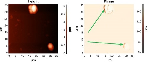 Figure 7 Saccharomyces cerevisiae yeast cells with magnetic nanoparticles.Note: AFM (left) and MFM image (right), showing chains (arrow) of artificial magnetic nanoparticles formed at the biomembranes of the cells, due to magnetic dipole–dipole interaction among the magnetic nanoparticles.Abbreviations: AFM, atomic force microscopy; MFM, magnetic force microscopy.