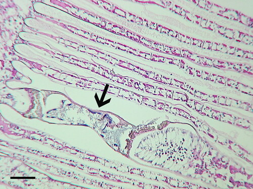 Figure 4. Synophrya sp. hypertrophont (arrow) in the gill lamellae of swimming crab, Achelous gibbesi collected from the South Atlantic Bight continental shelf (USA). H & E. Scale bar 100 µm.