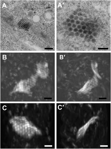 Fig. 5 Sheet-like ZIKV particle array.(a–a′) ZIKV paracrystalline (PC) array structure at low and high magnifications of  transmission electron micrographs (TEM). (b–b′) Reconstructed 3D images from focused ion beam scanning electron microscopy (FIB-SEM) at two different angels reveal a wavy sheet-like array of a single layer of ZIKV particles. (c–c′) Another sheet-like ZIKV particle array structure at two different angles. The clockwise rotation angles of (b′) and (c′) relative to (b) and (c) are 110 degrees around the vertical axis. Scale bar, 200 nm (a) and 100 nm (a′–c′)
