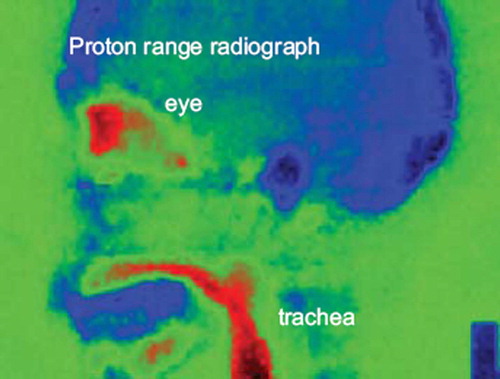 Figure 8. A proton radiograph of a phantom of the head [Citation58].