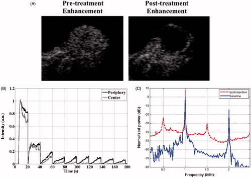 Figure 3. Figure illustrating vascular shutdown in a subcutaneous mouse tumour by ultrasound-stimulated microbubbles. (A) Example ultrasound contrast images at peak enhancement following microbubble injection prior to treatment (left) and after therapy exposures (right). These images illustrate qualitatively the reduction of perfusion resulting from the treatment, which preferentially affects the central regions of the tumour. Images are 1.5 cm lateral dimension. (B) An example of time–intensity contrast curves (central and peripheral regions of interest) following the bolus injection of contrast for a tumour during treatment. After an initial a rise to a peak as microbubbles enter the tumour, there is a gradual decay over several minutes which is associated with a systemic reduction in microbubble concentration in the bloodstream. Therapy pulses of 1 MHz (1.6 MPa peak negative pressure) are sent every 20 s, resulting in the destruction of agent within the tumour. In the peripheral region, substantial reperfusion occurs following each burst; however, in the central region there is a reduced level of reperfusion with successive burst, consistent with a reduction in blood flow in response to the treatment. (C) Example cavitation signals recorded from the microbubbles within the tumour during exposure to therapy pulses, expressed as a function of frequency in a decibel scale. The ‘baseline’ signal (solid) is taken prior to microbubble injection and arises from scattering of the incident US by tissue. Here a clear 1 MHz component (transmit frequency) along with a 2 MHz signal associated with (non-linear) propagation of the US pulse. Signals outside these frequencies are associated primarily with noise. For the microbubble signals (dashed) there are also pronounced peaks at 0.5 (subharmonic) and 1.5 MHz (ultraharmonic). The remaining substantial energy present across a wide range of frequencies is a hallmark of inertial cavitation, indicating the violent oscillations of microbubbles during the therapy pulses. Figure from Todorova et al. [Citation128].