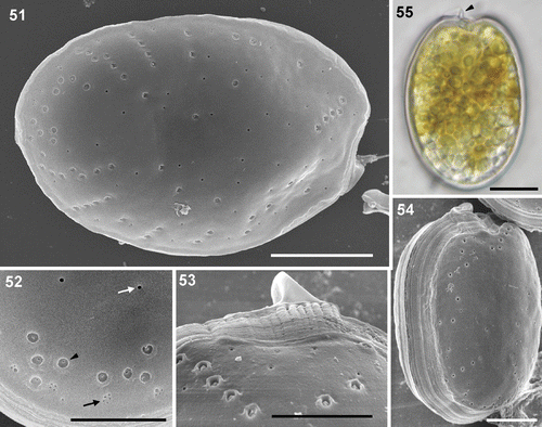 Figs 51–55. Prorocentrum rhathymum. 51–54. SEM. 51. Left valve showing the anterior spine-like prolongation and the pore pattern. 52. Detail of a valve portion containing three classes of pores: large (arrowhead), small (white arrow) and the clumps of smaller pores (black arrow) on the valve margin. 53. Anterior end showing the arrangement of the large pores in this area, the spine or collar and the longitudinal intercalary band, which appears transversally striated. 54. Side view of the left valve showing longitudinal striations of the intercalary band. 55. LM. Oval shaped cultured cell showing the spine at the anterior end. Scale bars: 5 µm (Figs 52, 53); 10 µm (Figs 51, 54, 55).