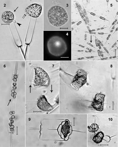 Figs. 2–10. Life-cycle stages in Ditylum brightwellii. Fig. 2. Live egg (arrow) and sperm (arrowhead) and auxospore (double arrow). Fig. 3. Fixed egg viewed with bright-field microscopy. Fig. 4. The same egg stained with DAPI. Fig. 5. Mass spermatogenesis in a live culture. Note swelling of spermatogonia (arrow). Fig. 6. Spermatogonangium with rudimentary thecae (arrow) in 1% glutaraldehyde and formaldehyde fixative. Fig. 7. Early stage auxospores in living preparation. Note properizonium (arrows). Fig. 16. Auxospores developed fully; formation of both valves of the initial cells is nearly complete (living preparation). Fig. 17. Resting spore of Ditylum brightwellii in a clonal culture from a natural population at Wadsworth Cove (fixed sample). Fig. 18. Vegetative cell enlargement in living Ditylum brightwellii. Scale bars: 10 µm.
