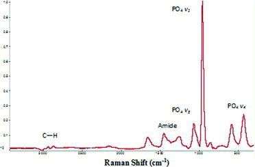 Figure 3 Raman spectroscopy of sound dentin.