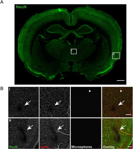 Figure 4. Biodegradable microspheres do not induce overt neuronal damage. (A) Overview image of a coronal brain section stained for the pan-neuronal marker NeuN (green). Two insets show minor infarcted areas in the intervention side, enlarged in (B). This image is from an animal injected with M3 microspheres. Scale bar = 1 mm. (B) Enlarged images of the minor infarcts from (A). i: Infarcted region in the striatum, accompanied by local nonperfusion (red; lack of lectin perfusion), with a microsphere in the vicinity (white; arrow head). ii: Infarcted region in the cortex, accompanied by local nonperfusion, but no microsphere in the near vicinity (in this brain section). This is an example of one of the larger infarcts found, yet it is still relatively small. Scale bar is 100 µm for both images. Arrow: infarcted region, arrowhead: microsphere.