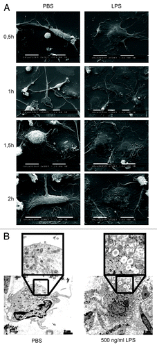 Figure 3. LPS stimulates rapid macrophage activation. (A) Human macrophages were incubated with either PBS or LPS and cells were analyzed by SEM at different time points. (B) Macrophages were treated with PBS or LPS for 2 h and then analyzed by TEM. Representative pictures are shown.
