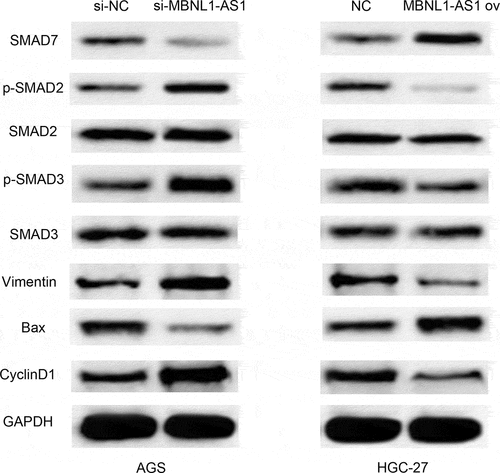 Figure 9. MBNL1-AS1 affects TGF-β/SMAD pathways by regulating Smad7. Western blot showing the correlated protein levels of TGF-β pathway markers (p-Smad2, p-Smad3, Smad2, and Smad3), apoptosis-related protein Bax, cyclin pathway-related protein Cyclin D1, and EMT marker Vimentin in GC with MBNL1-AS1 knockdown or overexpression.