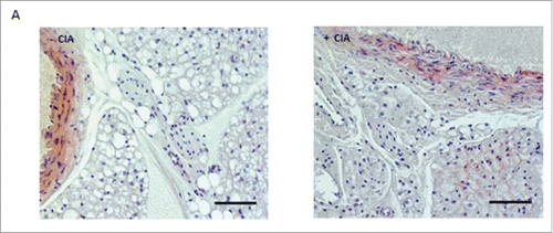 Figure 1. Morphological differences in abdominal PVAT between naïve and CIA mice. Sime et. al., p. 93.